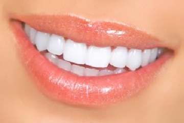 Bleaching Zahnklinik ThermalDent Sárvár