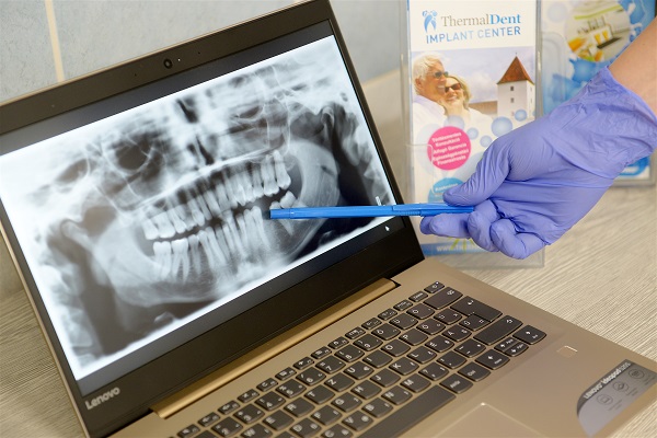 Kronen ThermalDent Sárvár in Ungarn